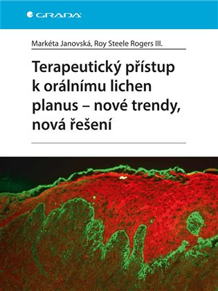 Terapeutický přístup k orálnímu lichen planus