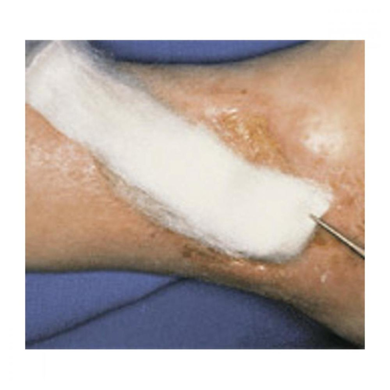 Krytí Suprasorb A+Ag 10x10cm sterilní 10ks