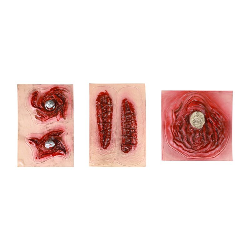 RAPPA Jizvy samolepící