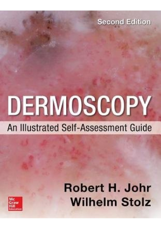 Dermoscopy: An Illustrated Self-Assessment Guide, 2/e McGraw-Hill Education - Europe
