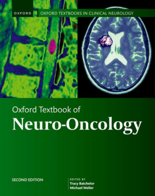 Oxford Textbook of Neuro-Oncology Oxford University Press