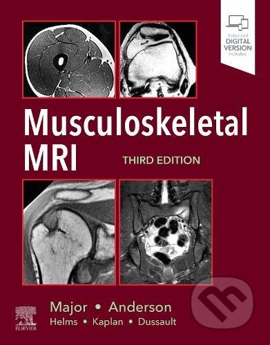Musculoskeletal MRI - Nancy M. Major, Mark W. Anderson - kniha z kategorie Medicína