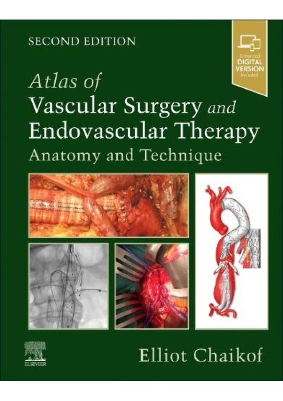 Atlas of Vascular Surgery and Endovascular Therapy, Anatomy and Technique Elsevier - Health Sciences Division