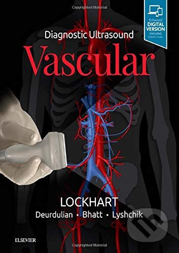Diagnostic Ultrasound: Vascular - Mark E. Lockhart - kniha z kategorie Medicína