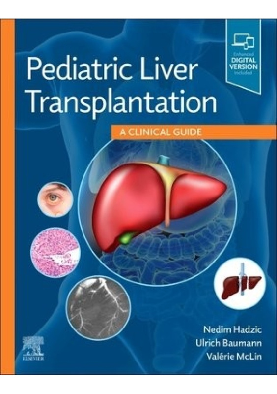 Pediatric Liver Transplantation, A Clinical Guide Elsevier - Health Sciences Division