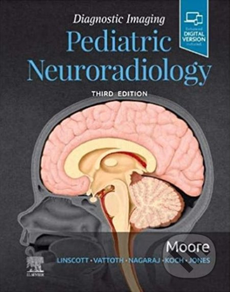 Diagnostic Imaging: Pediatric Neuroradiology - Kevin R. Moore - kniha z kategorie Medicína