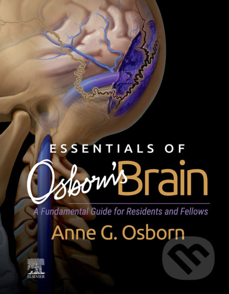 Essentials of Osborn's Brain (A Fundamental Guide for Residents and Fellows) - kniha z kategorie Medicína