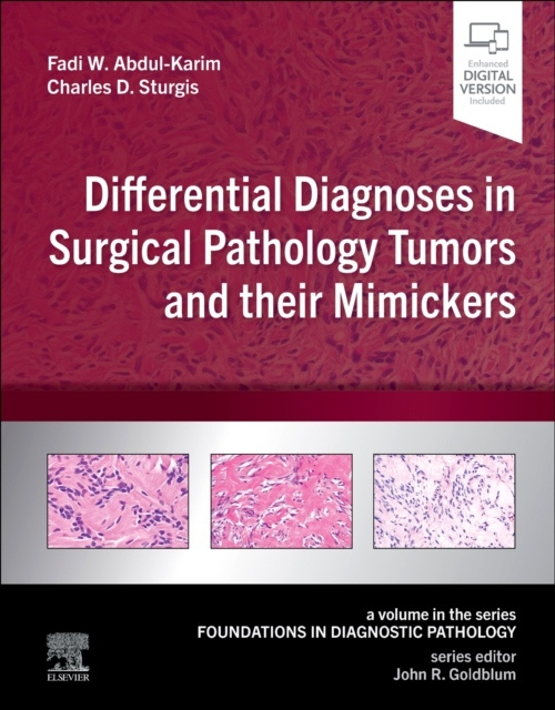Differential Diagnoses in Surgical Pathology Tumors and their Mimickers, A Volume in the Foundations in Diagnostic Pathology series Elsevier