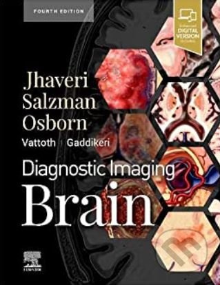 Diagnostic Imaging: Brain - Miral D. Jhaveri - kniha z kategorie Odborné a naučné