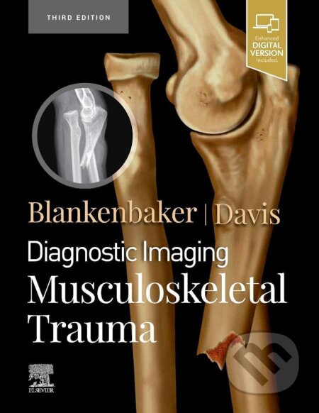 Diagnostic Imaging: Musculoskeletal Trauma - Donna G. Blankenbaker,  Kirkland W. Davis