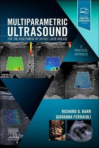 Multiparametric Ultrasound for the Assessment of Diffuse Liver Disease - kniha z kategorie Medicína
