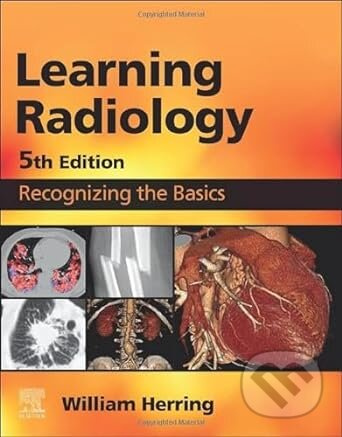 Learning Radiology (Recognizing the Basics (5th Edition)) - kniha z kategorie Odborné a naučné