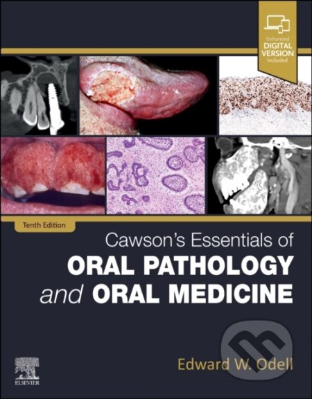 Cawson's Essentials of Oral Pathology and Oral Medicine - kniha z kategorie Stomatologie a dentální hygiena
