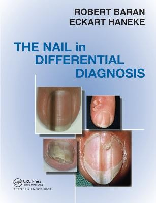 Nail in Differential Diagnosis Taylor & Francis Ltd