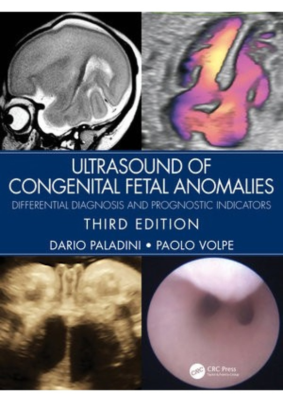 Ultrasound of Congenital Fetal Anomalies, Differential Diagnosis and Prognostic Indicators Taylor & Francis Ltd