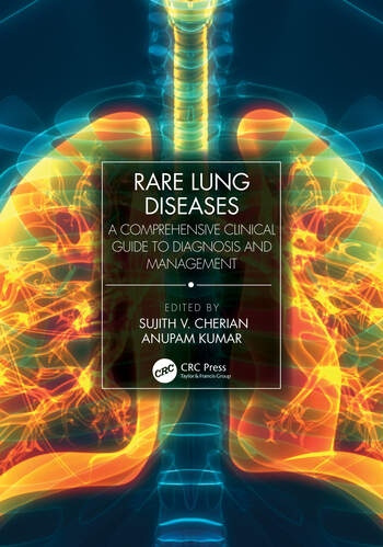 Rare Lung Diseases Taylor & Francis Ltd