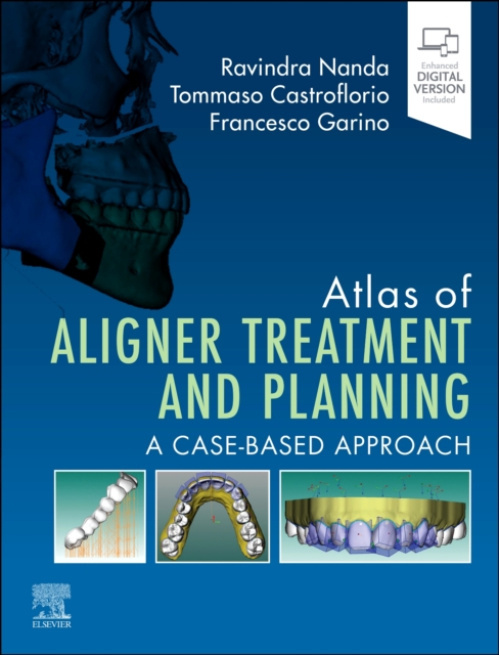 Atlas of Aligner Treatment and Planning, A Case-Based Approach Elsevier Health Sciences