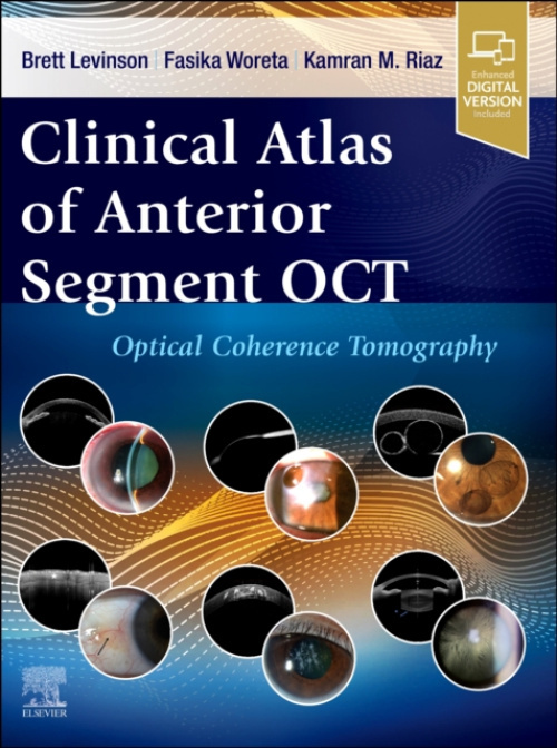 Clinical Atlas of Anterior Segment OCT: Optical Coherence Tomography Elsevier Health Sciences