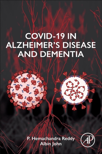 COVID-19 in Alzheimer´s Disease and Dementia Elsevier