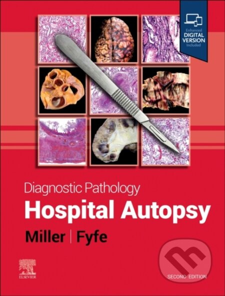 Diagnostic Pathology: Hospital Autopsy - Dylan V. Miller, Billie S. Fyfe - kniha z kategorie Medicína