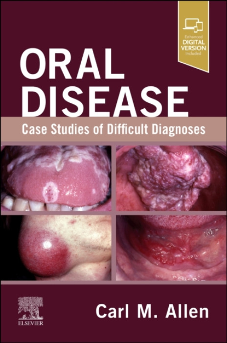 Elsevier Health Sciences Oral Disease: Case Studies of Difficult Diagnoses - Allen, Carl M., DDS, MSD (Division of Oral and Maxillofacial Pathology and Radiology, College of Dentistry, The Ohio State University, Columbus, Ohio, USA)