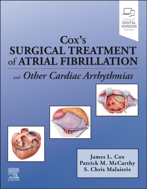 Coxs Surgical Treatment of Atrial Fibrillation Elsevier Health Sciences