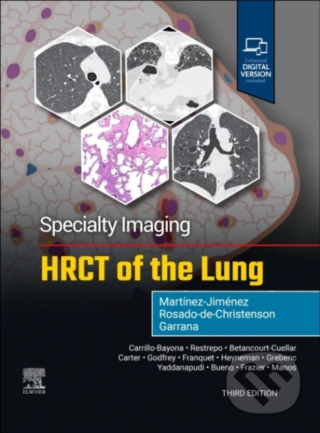 Specialty Imaging: HRCT of the Lung - FAAWR Rosado-de-Christenson - kniha z kategorie Onkologie