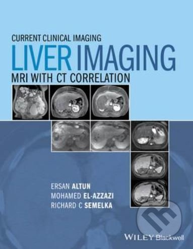 Liver Imaging (MRI with Ct Correlation) - Ersan Altun, Mohamed Elazzazi, Richard C. Semelka, Larissa Braga - kniha z kategorie Medicína
