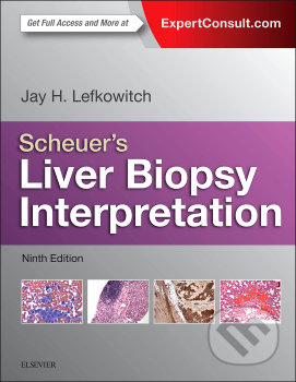 Scheuer's Liver Biopsy Interpretation - Jay Lefkowitch - kniha z kategorie Odborné a naučné
