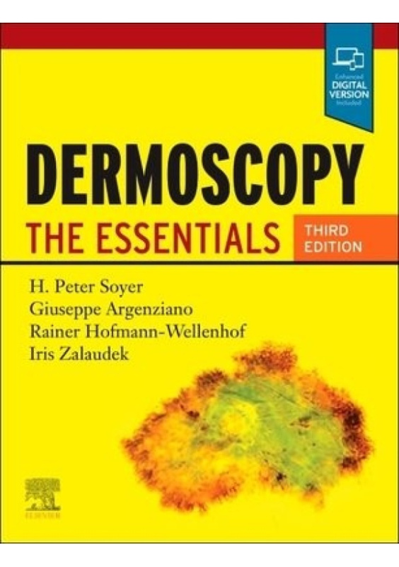 Dermoscopy, The Essentials Elsevier Health Sciences