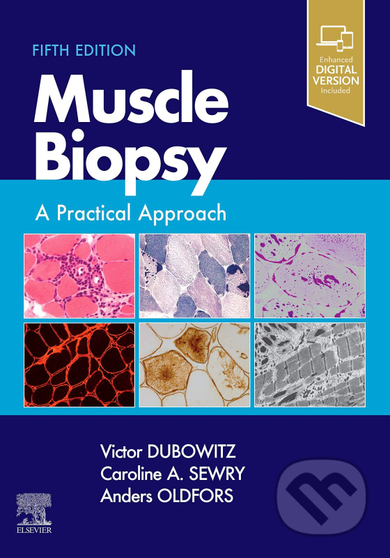 Muscle Biopsy (A Practical Approach) - Victor Dubowitz Caroline Sewry Anders Oldfors - kniha z kategorie Medicína