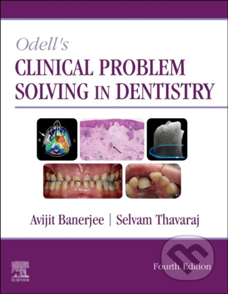 Odell's Clinical Problem Solving in Dentistry, 4th Edition - kniha z kategorie Medicína
