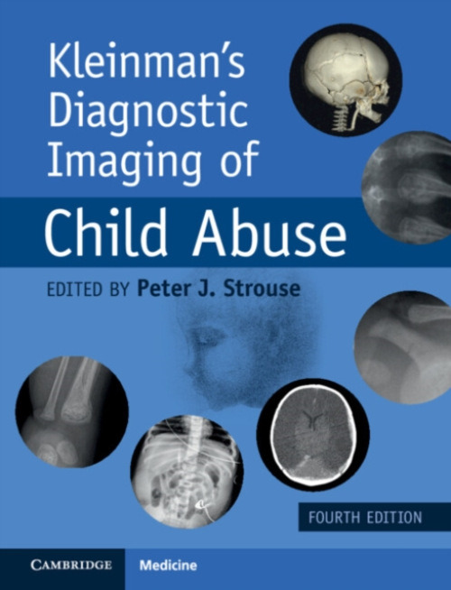 Cambridge University Press Kleinman's Diagnostic Imaging of Child Abuse