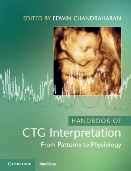 Handbook of CTG Interpretation, From Patterns to Physiology Cambridge University Press
