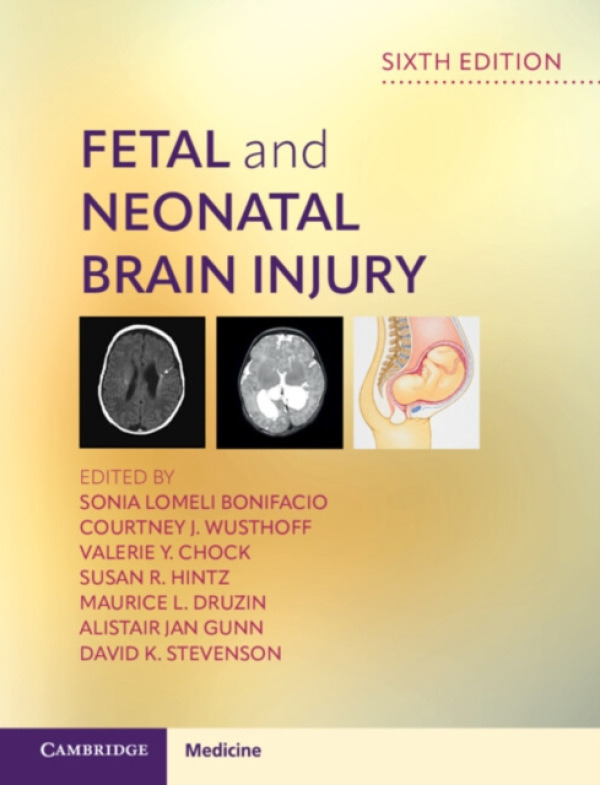 Cambridge University Press Fetal and Neonatal Brain Injury