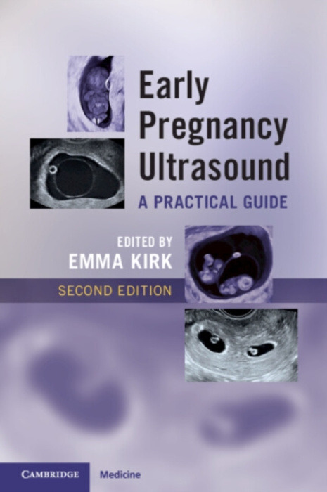Cambridge University Press Early Pregnancy Ultrasound