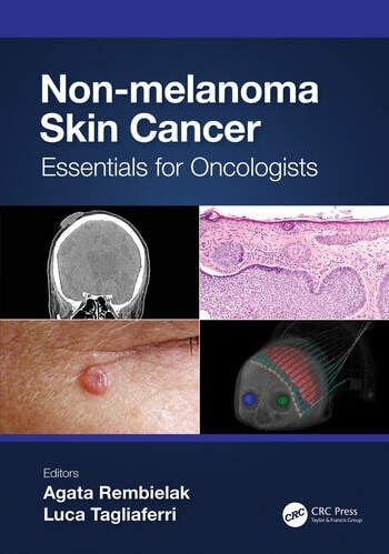 Non-melanoma Skin Cancer Taylor & Francis Ltd