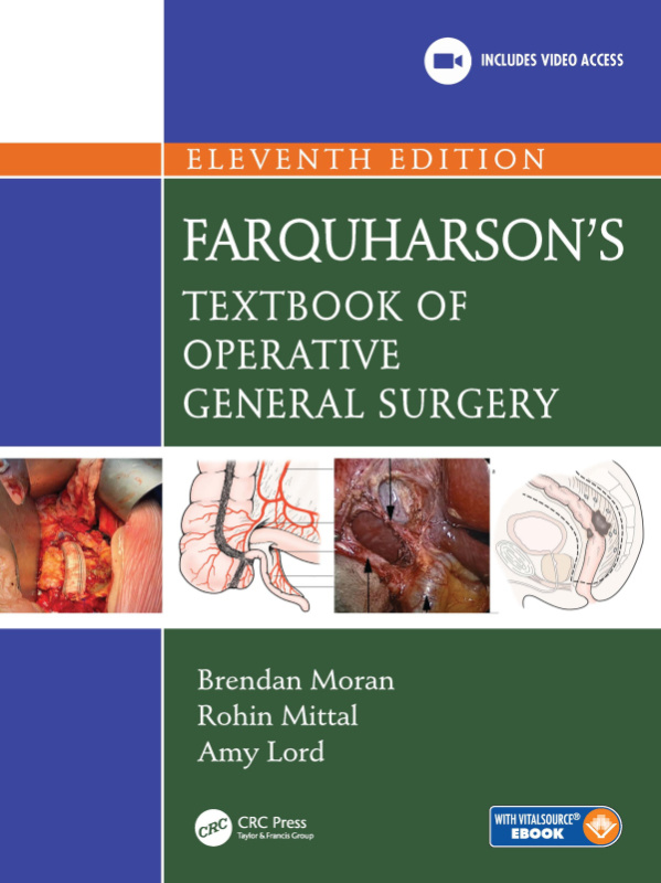 Farquharsons Textbook of Operative General Surgery CRC Press