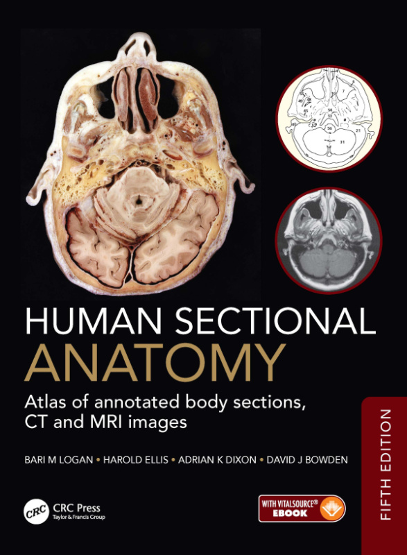 Human Sectional Anatomy CRC Press