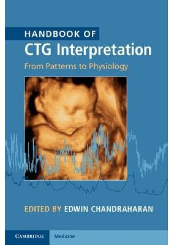 Handbook of CTG Interpretation, From Patterns to Physiology Cambridge University Press
