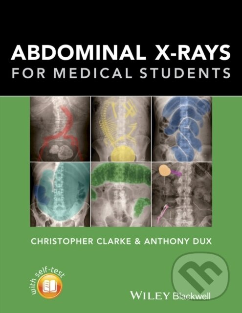 Abdominal X-rays for Medical Students - Anthony Dux, Christopher Clarke