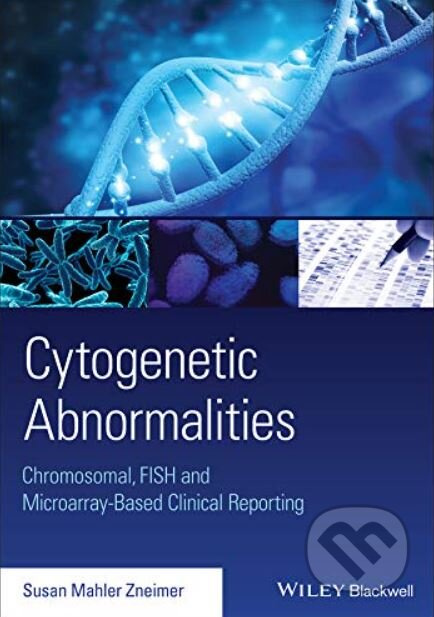 Cytogenetic Abnormalities (Chromosomal, FISH, and Microarray-Based Clinical Reporting and Interpretation of Result) - kniha z kategorie Mikrobiologie…