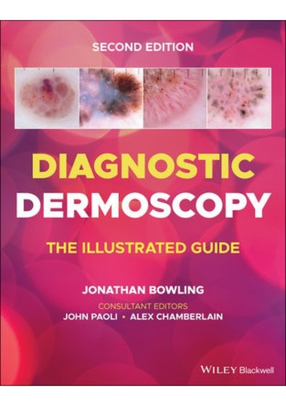 Diagnostic Dermoscopy, The Illustrated Guide John Wiley and Sons Ltd