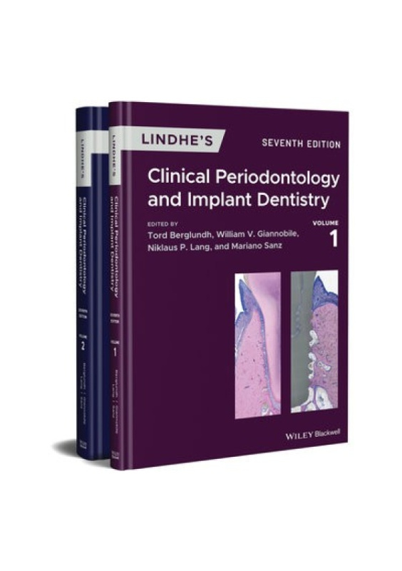 Lindhes Clinical Periodontology and Implant Dentistry, 2 Volume Set John Wiley and Sons Ltd