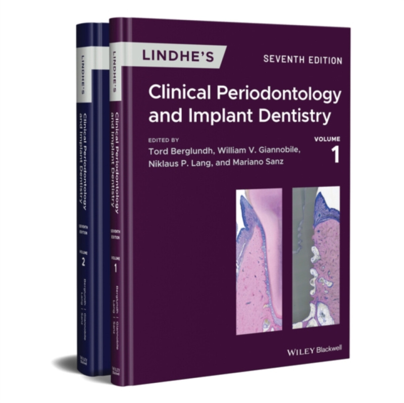 Lindhes Clinical Periodontology and Implant Dentistry, 2 Volume Set John Wiley and Sons Ltd