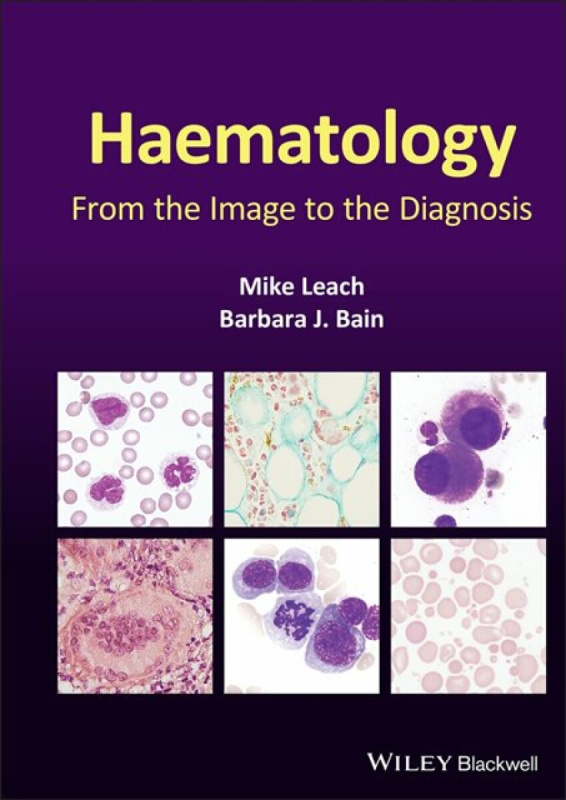 Haematology â€“ From the Image to the Diagnosis - Barbara J.  Bain, Mike  Leach
