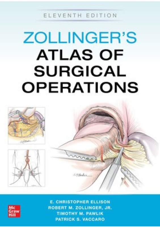 Zollingers Atlas of Surgical Operations, Eleventh Edition McGraw-Hill Education