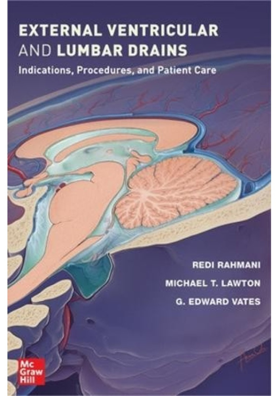 External Ventricular and Lumbar Drains: Indications, Procedures, and Patient Care McGraw-Hill Education
