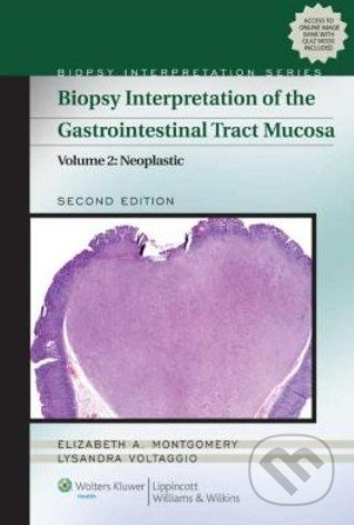 Biopsy Interpretation of the Gastrointestinal Tract Mucosa (Volume 2) - kniha z kategorie Odborné a naučné