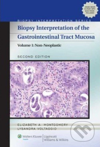 Biopsy Interpretation of the Gastrointestinal Tract Mucosa (Volume 1) - kniha z kategorie Odborné a naučné